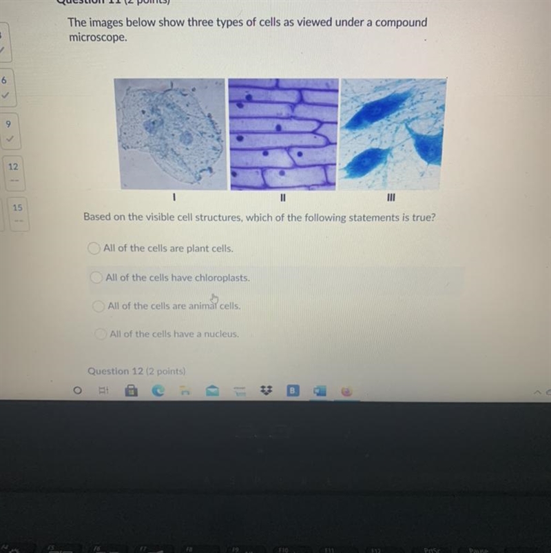 Based on the visible cell structure, which of the following statements is true?-example-1