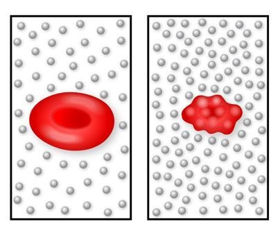 The diagram shows a normal red blood cell and a shrunken red blood cell, both of which-example-1