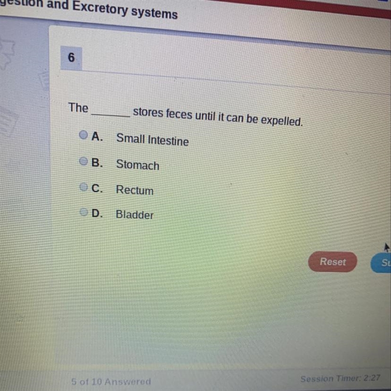 Is it small intestine or Stomach or Rectum or Bladder-example-1