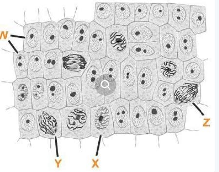 Which cell most recently underwent metaphase? A student is looking through a microscope-example-1