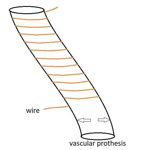 You are designing a vascular prosthesis made of woven Dacron and you would like to-example-1