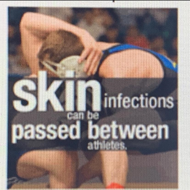 Preview the poster and identify the main idea a. Athletes share infections b. Infections-example-1