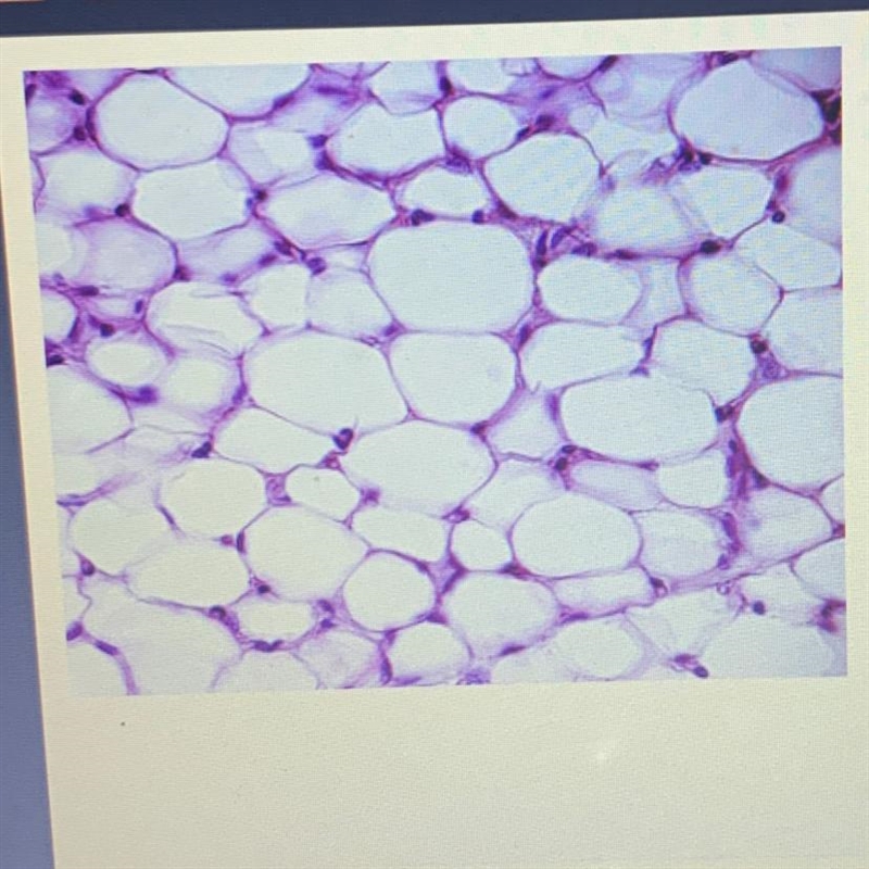 Which level of organization is pictured? A cell B tissue C organ D organ system-example-1