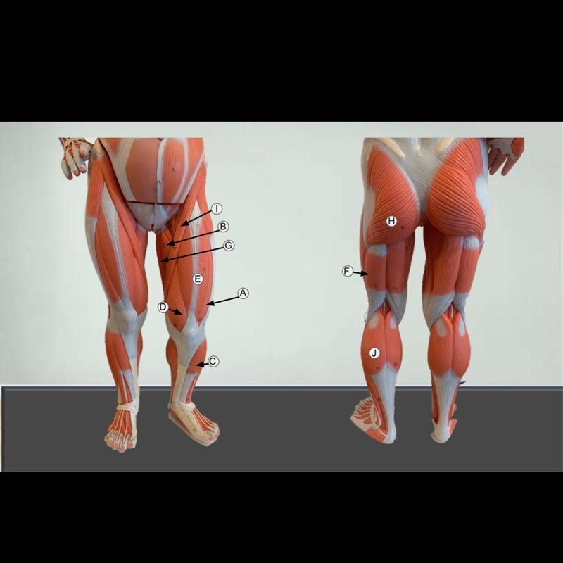 Label the following Muscles : Biceps Femoris Gastrocnemius Gluteus Maximus Rectus-example-1