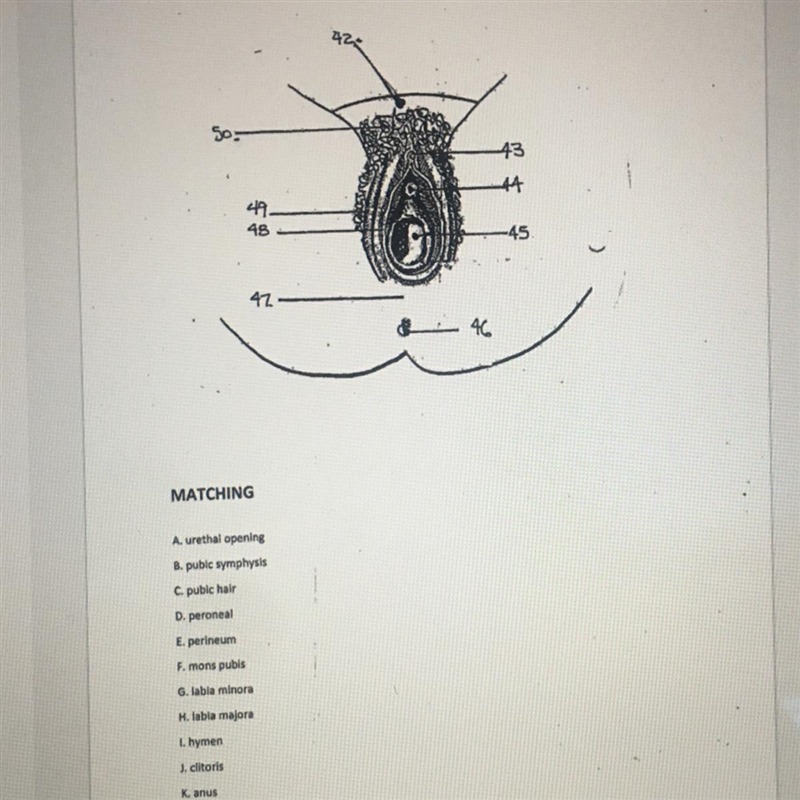 Anatomy diagram.... matching-example-1