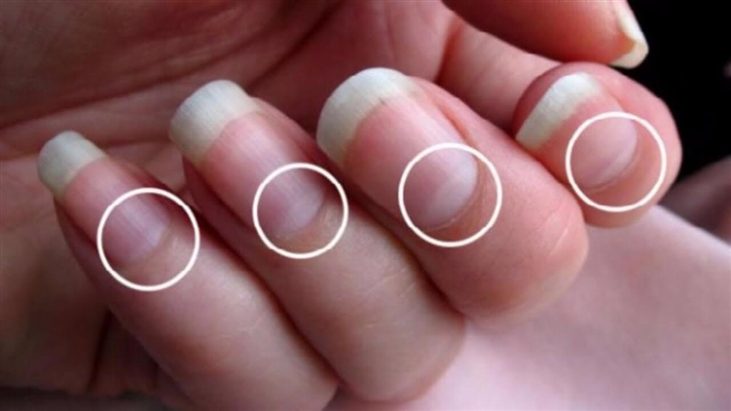 8. The "little moon” of your nail is the: a. Cuticle b. Lunula c. Nail body d-example-1