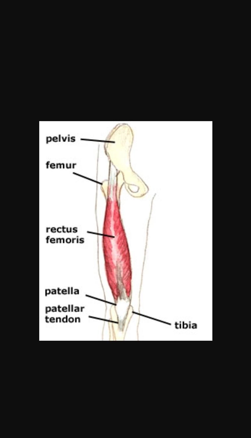 Quads are located.... A. Below the femur B. A top the femur C. To the right of the-example-1