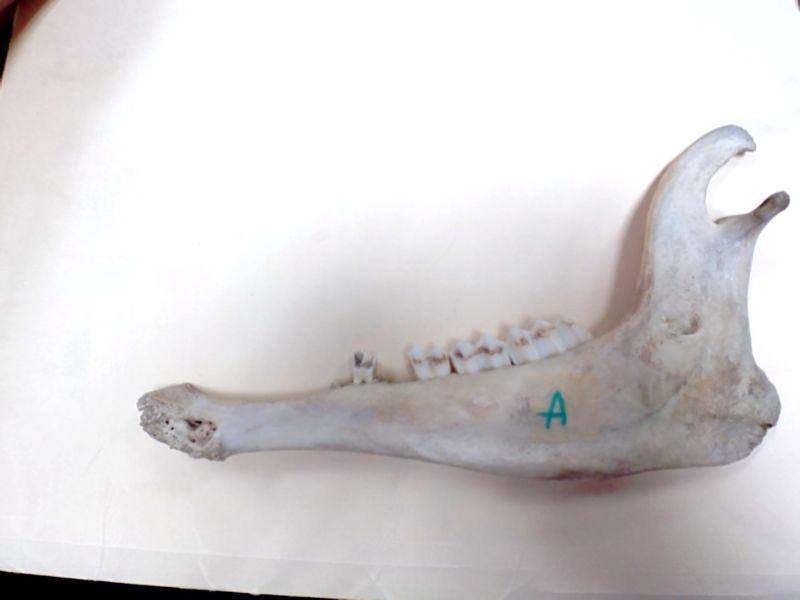 What is the name of this bone?-example-1