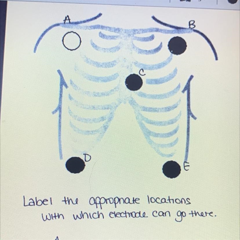 Level the appropriate location with which electrode can go there-example-1