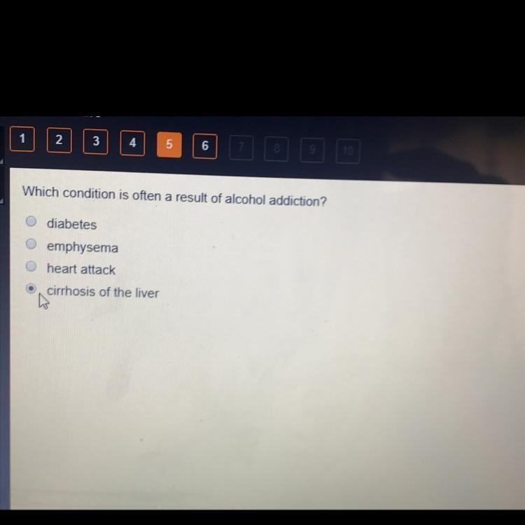 Which condition is often a result of alcohol addiction?-example-1