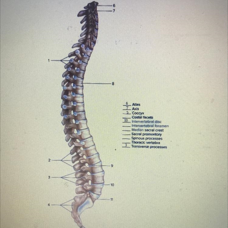 Can someone help me !?-example-1