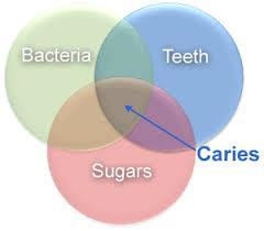 Oral bacteria and dietary sugars are two of the three parts of the "Etiology-example-1