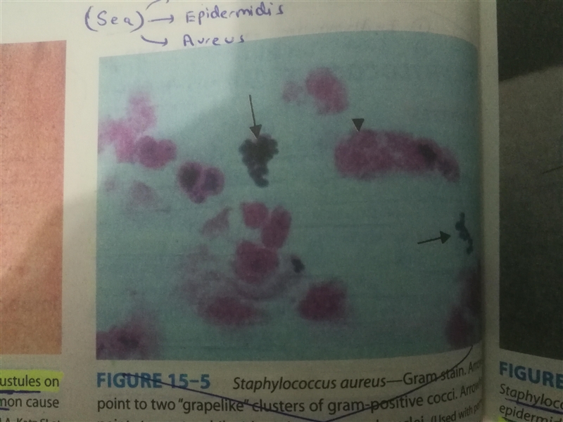 The bacterium Staphylococcus aureus is commonly found in the nasal cavity of healthy-example-1