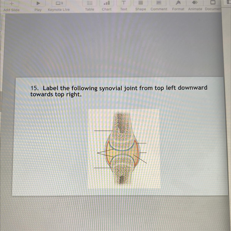 Label the following synovial joint from top left downward towards top right.-example-1