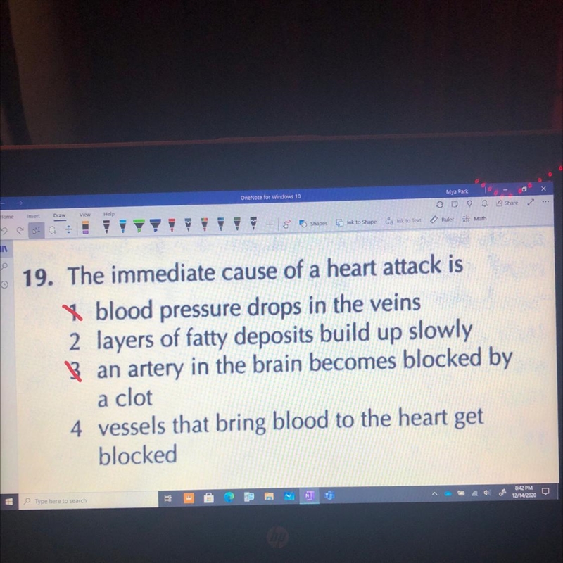 19. The immediate cause of a heart attack is... 1 blood pressure drops in the veins-example-1