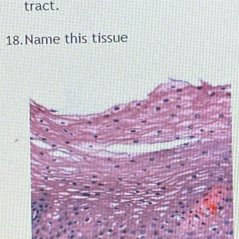 Please help meee name this tissue-example-1