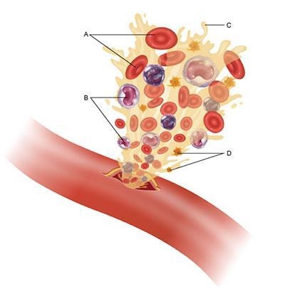 Which of the blood components in the diagram would proliferate during a viral infection-example-1