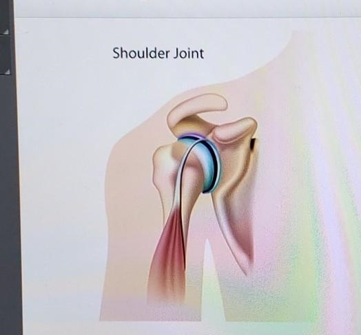 What is the flexible connective tissue shown in blue? Shoulder Joint O tendon O bone-example-1