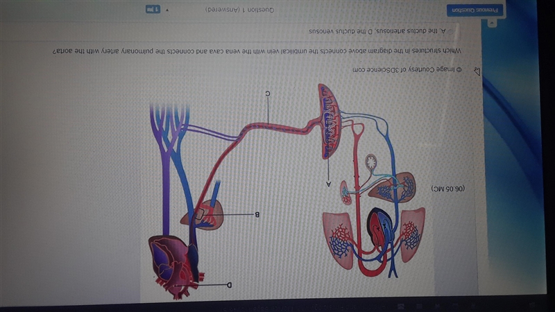 Which structures in this diagram above connects the umbilical vein with the vena cava-example-1