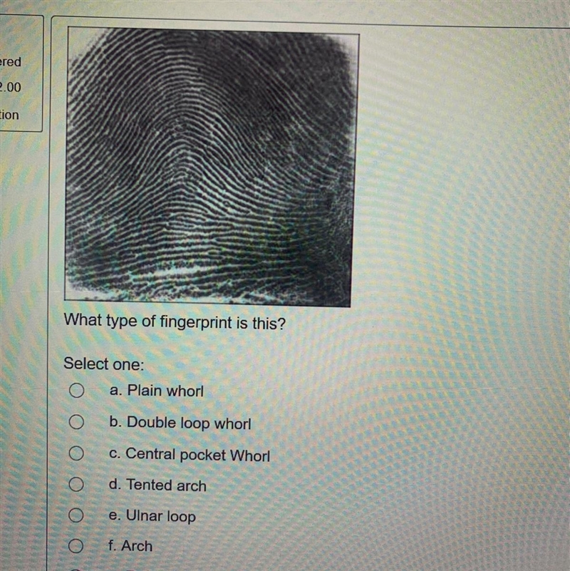 What type of fingerprint is this? Select one: a. Plain whorl b. Double loop whorl-example-1