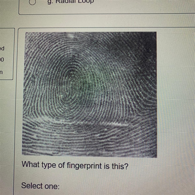 What type of fingerprint is this? Select one: a. Radial loop O b. Double loop whorl-example-1