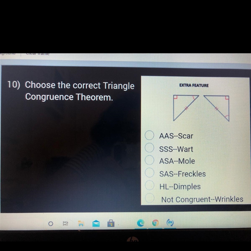 Choose the correct Triangle Congruence Theorem-example-1