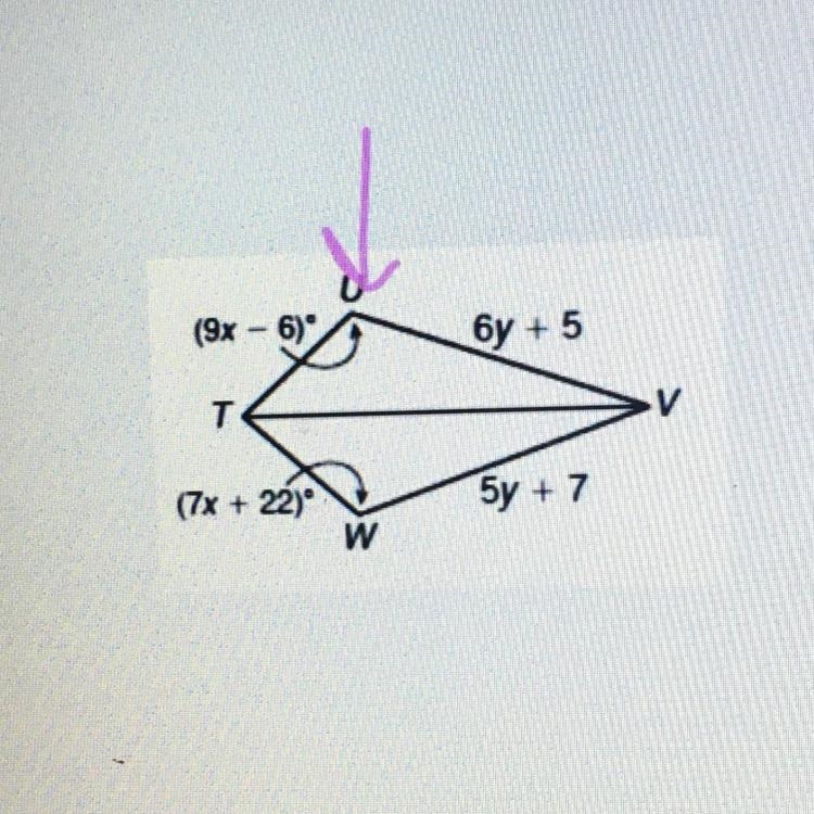 HELPPP PLSSSS What is the measure of angle U ??????-example-1