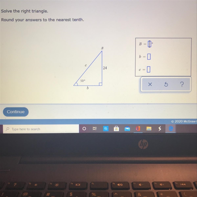 Please Help!!! Solve the right triangle. Round your answers to the nearest tenth. B-example-1