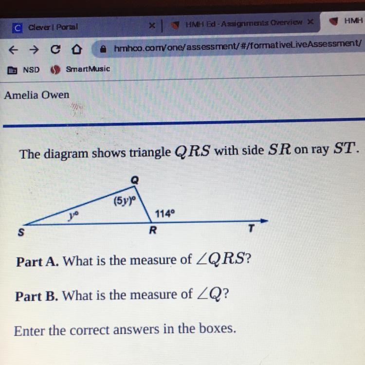 Part A: what is the measure of QRS? Part B; what is the measure of Q?-example-1