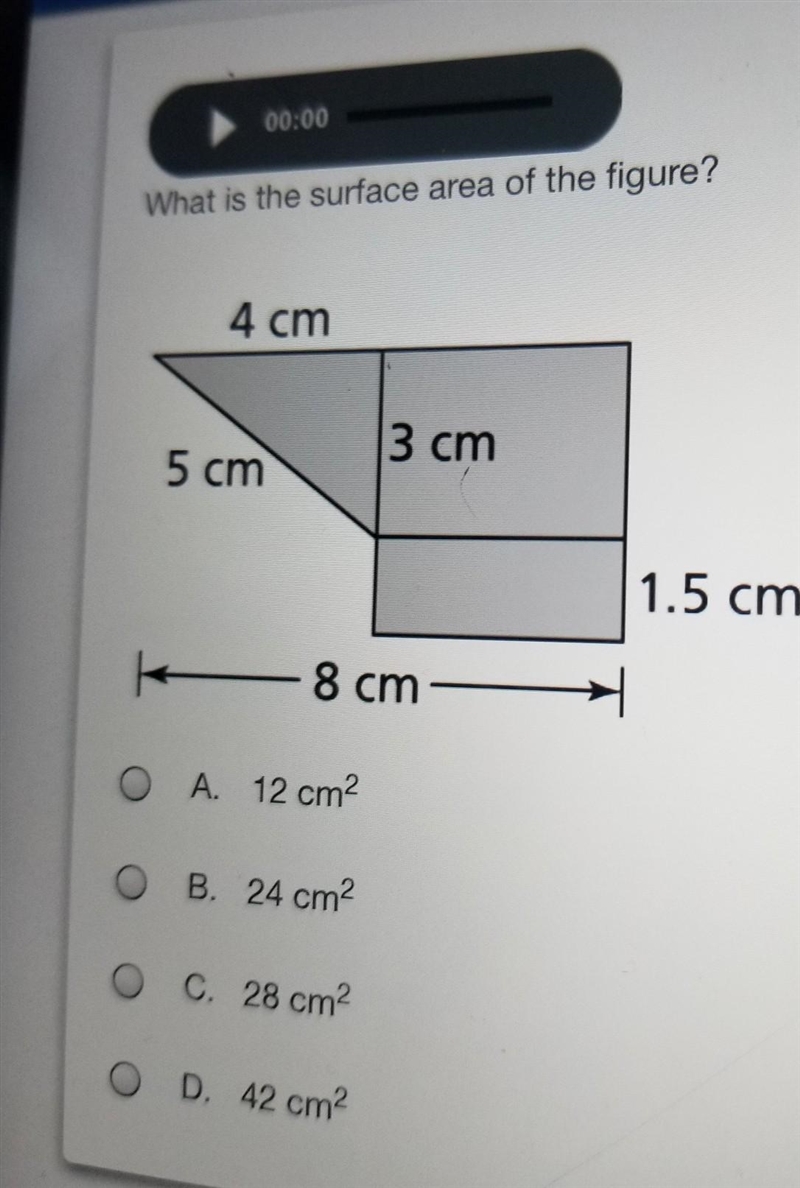 What is the surface area of the figure?​-example-1