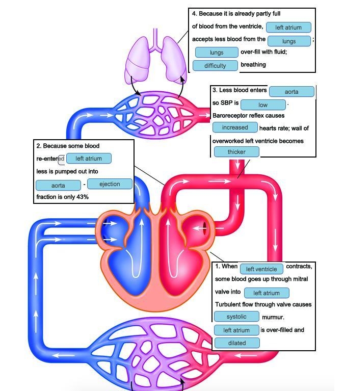 There is a note in Mr. G's chart that he had a color flow Doppler echocardiogram done-example-1