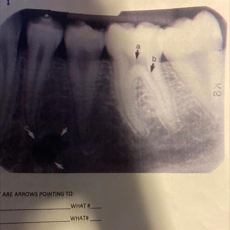 WHAT ARE ARROWS POINTING TO: A. WHAT # B. WHAT# C. WHAT TYPE OF FILM IS THIS? (Dentistry-example-1