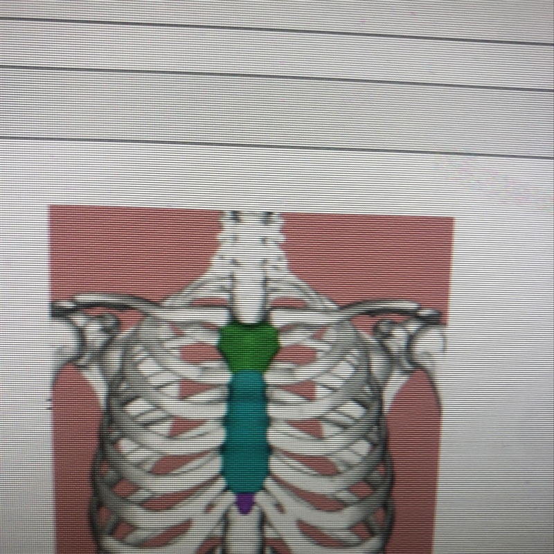 Name the top portion of this bone A. sacrum B.coccyx C.manubrium D.sternum-example-1