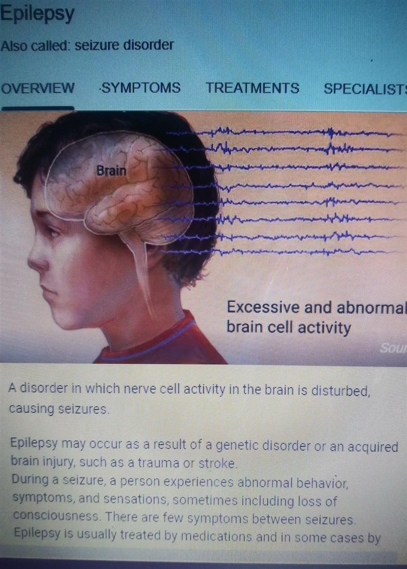 What is epilepsy? What are the two different types of epilepsy?-example-1