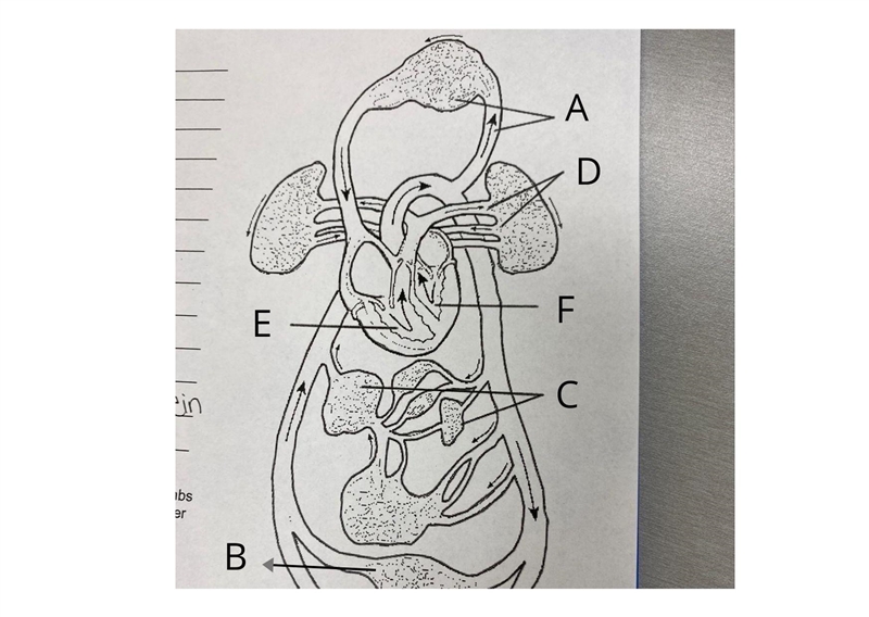 Label the Diagram - Vessels serving the head and upper limbs B - Vessels serving the-example-1