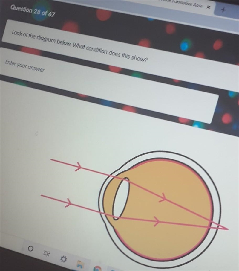 Look of the diagram below. What condition does this show? Enter your answer​-example-1