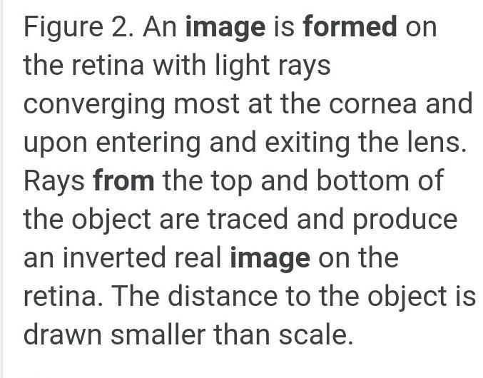 Human eye forms an ____________ image on _________after passing through the lens-example-1