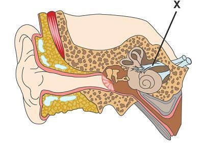 This is a diagram of the ear. Which structure is marked with an X? optic nerve auditory-example-1