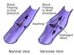 . physiology chapter 14 In what ways is the heart unlike most human-built pumps? Why-example-1