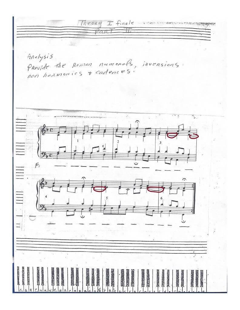 Can You Find The Suspension Chords?-example-1