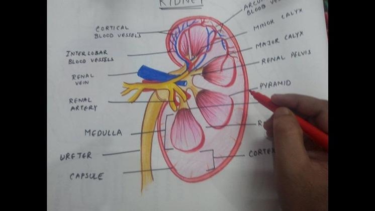 Can someone copy and draw this? Expect can the kidney color be orange?-example-1