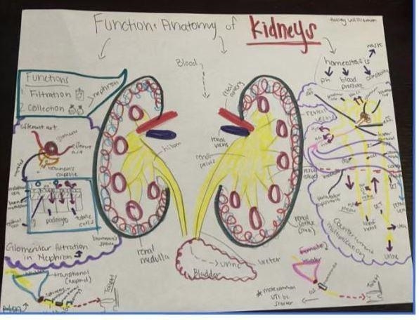 Can someone copy and draw this? Expect can the kidney color be orange?-example-1