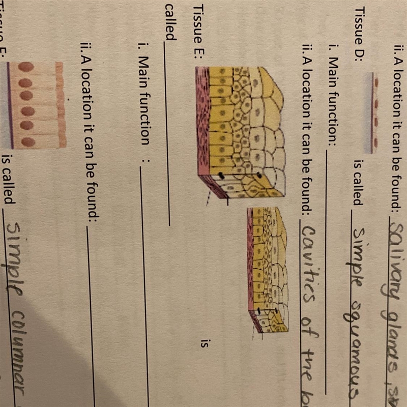 Letter E. What is the tissue called?-example-1