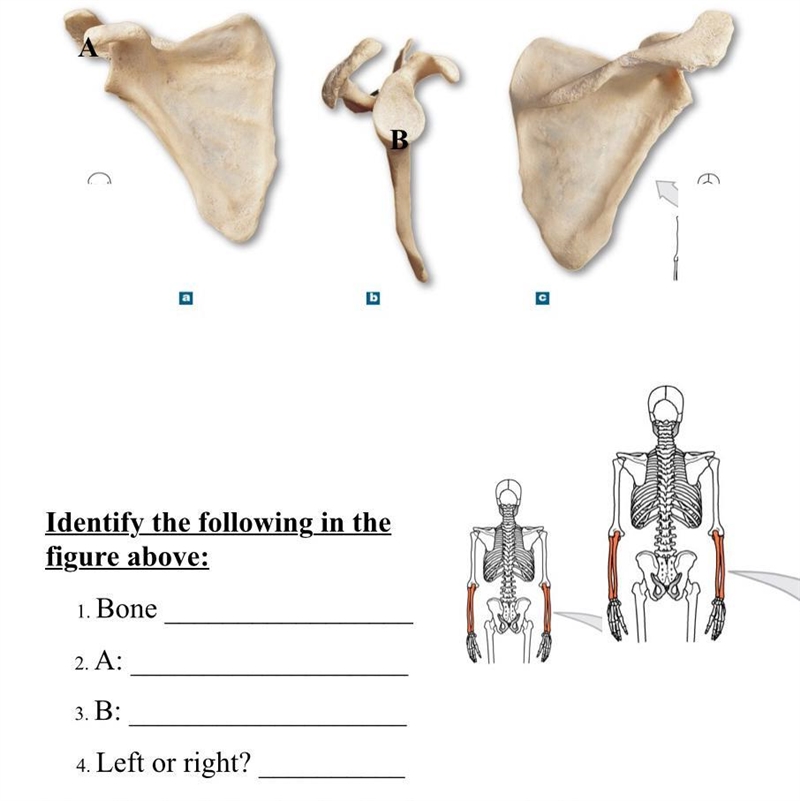 Identify the following in the bone to the right:-example-1