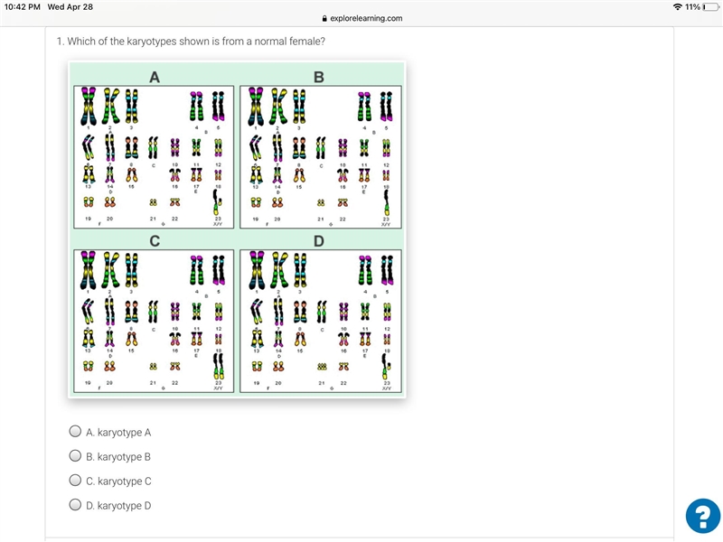 Which of the karyotypes shown is from a normal female?-example-1