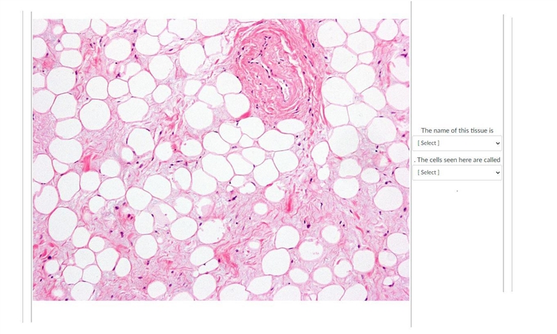 Name that tissue. what is this tissue?-example-1