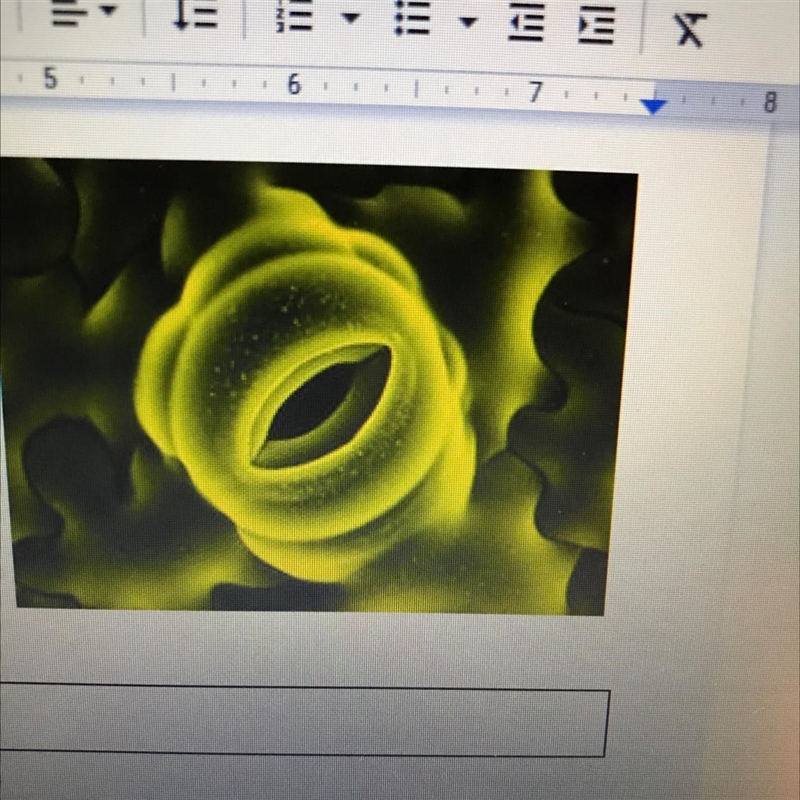 Is this stomata open or closed??-example-1