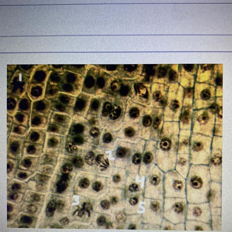 The image shows a section of a root tip of Broad Bean with cells from the region of-example-1