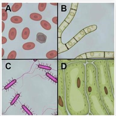 Which of the samples shown below are eukaryotic? 1) B and D 2) B and C 3) A, C, and-example-1