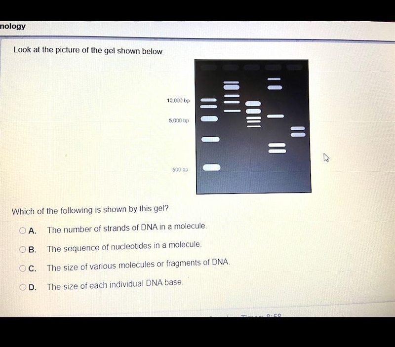 Which of the following is shown by this gel ?-example-1